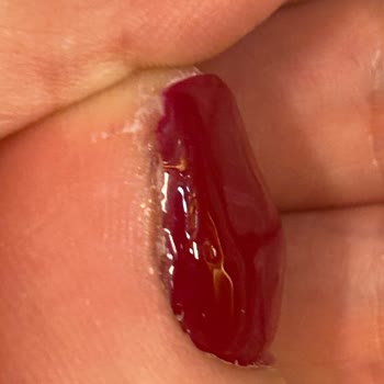 Durgut Foot Care Mağduriyet Yaşama