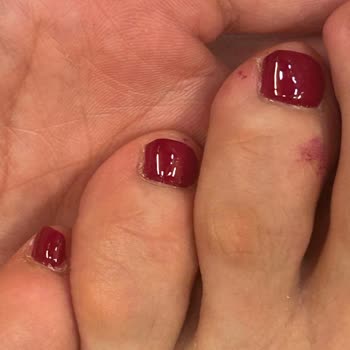 Durgut Foot Care Mağduriyet Yaşama