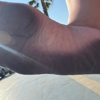 Hilltown Terliğinde Boya Sızması Ve Cilt Lekesi Sorunu