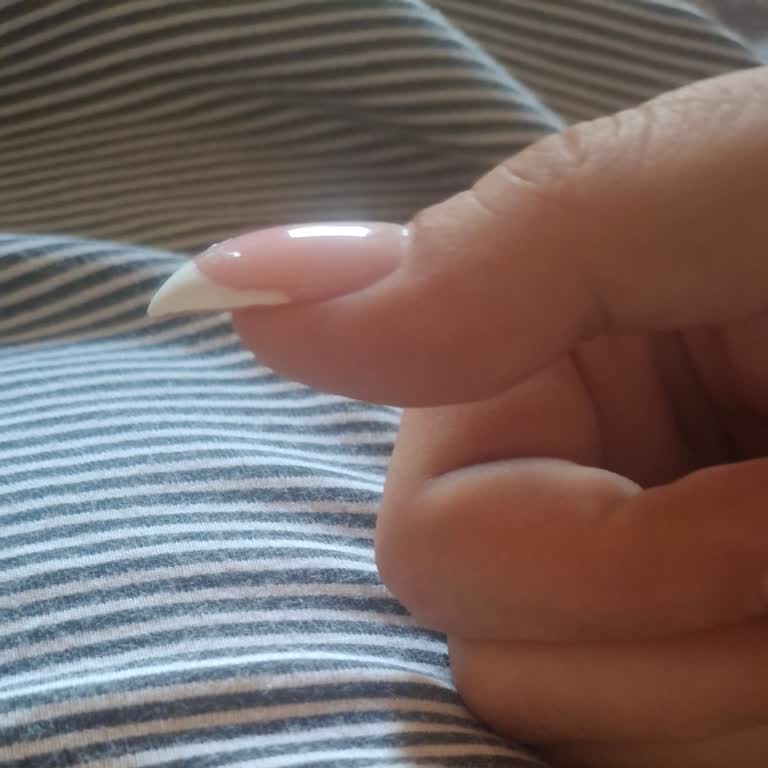 Jel Tırnak İşlemi Sonrası Memnuniyetsizlik Ve Telafi Talebi