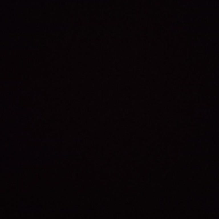 Direksiyon Ses Problemi Yanıltıcı Teşhis Ve Güven Kayıplı Servis Deneyimi