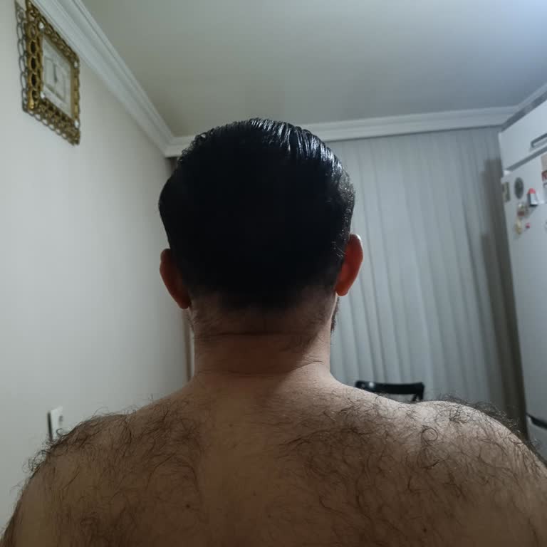 Bunee Saç Tozu Mağduriyeti