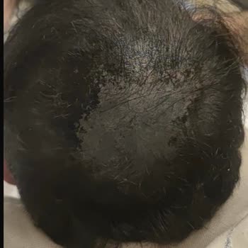 Batçı Cosmetic Reklamlarında ve Tanıtımlarında Anlattıkları Hiçbir Özelliği Gerçeği Yansıtmıyor