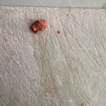 BİM Beşler Sucuğunda Taş: Çocuğumun Dişi Kırıldı