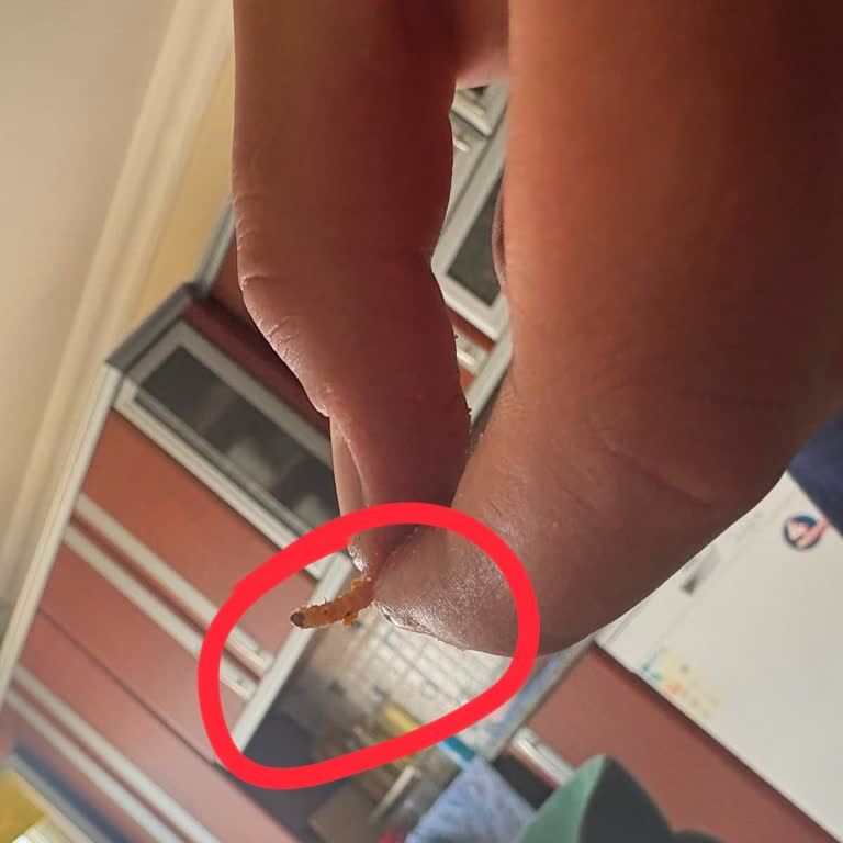 Patos Cipsinde Böcek Görüldü: Gıda Güvenliği Ve Hijyen Endişesi