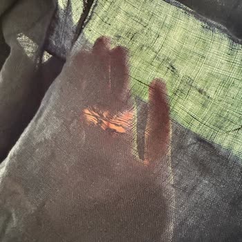 Mavi Keten Şort Hızlı İncelip Yırtıldı, Mağaza Kullanıcı Hatası Dedi