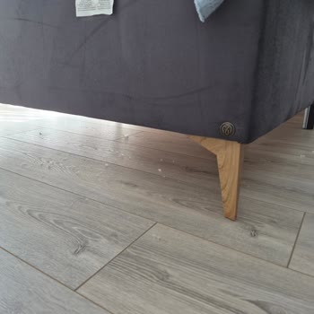 Mondi Baza Başlığında Artan Tüy Dökülmesi Ve Ürün Değişimi Talebi