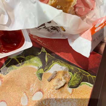 Burgerde Kemik Parçası: Boğaza Batması Ve Sağlık Riski
