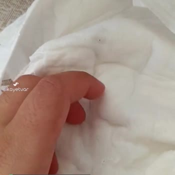 Sleepy Yeşil Plastik Parçalar Çıktı Bezin İçinden