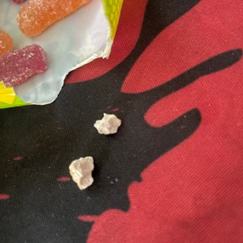 Kent Jelibonunda Yabancı Sert Parçalar Diş Sızlamasına Neden Oldu
