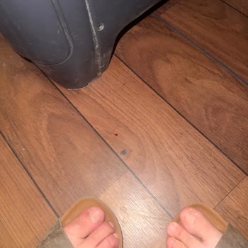Böcek Ve Parazit Sorunu Nedeniyle Hijyen Skandalı Ve Sağlık Riski