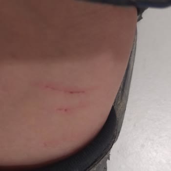 Demir Çubuklu Tezgâhta Çocuk Kesildi, Mağaza Cevap Vermedi