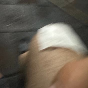 Duş Camı Patlaması Sonrası Yaralanma Ve Haksız Ücret İadesi