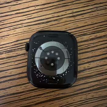 Apple Watch Series 11'te Boya Atması Ve Ürün Değişim Talebi
