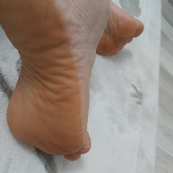 Deichmann Terlikte Ayıplı Boya Akması Ve Taban Bozulması İade Reddi