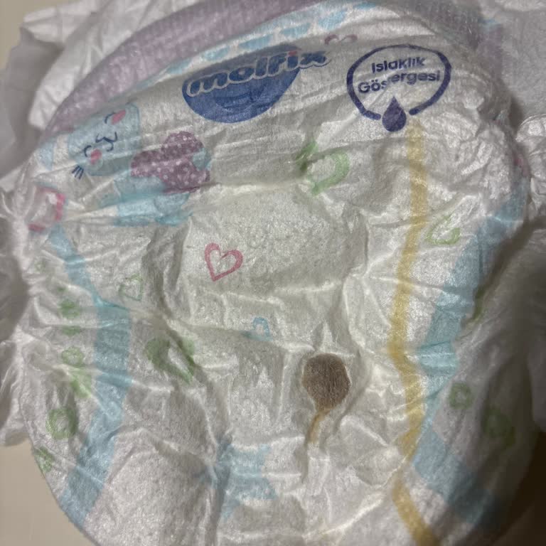 Üst Üste Sorunlu Molfix Bebek Bezleri Nedeniyle Yaşanan Mağduriyet