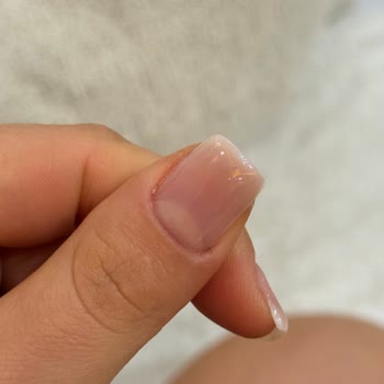 Nirvana Estetik İzmit Hijyen Eksikliği ve Kötü Uygulama