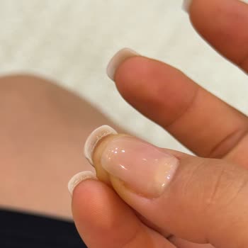 Nirvana Estetik İzmit Hijyen Eksikliği ve Kötü Uygulama