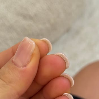 Nirvana Estetik İzmit Hijyen Eksikliği ve Kötü Uygulama