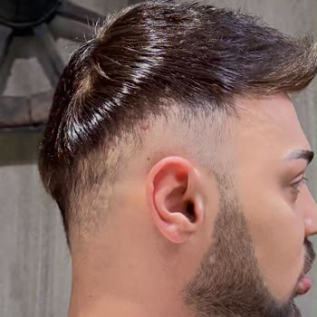 Saç Protez Bakımında Bilinçli Saç Sökülmesi Ve Mağduriyet