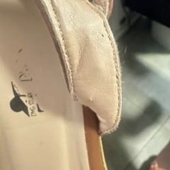 Sağlık Riski Taşıyan Sandalette Tel Sorunu Ve Satıcı Sorumluluk Reddi