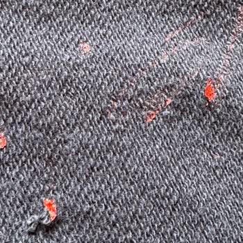Bebek Sweatshirt’ündeki Gizli Plastik Yanık Cilde Zarar Verdi