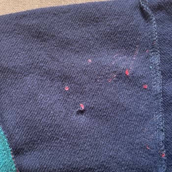Bebek Sweatshirt’ündeki Gizli Plastik Yanık Cilde Zarar Verdi