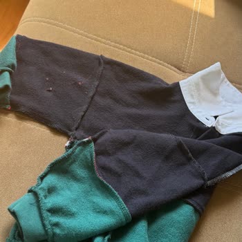 Bebek Sweatshirt’ündeki Gizli Plastik Yanık Cilde Zarar Verdi