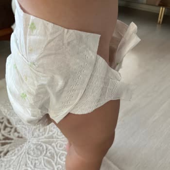 Yapışkan Bant Sorunu Nedeniyle Bebek Bezinin Düşmesi Ve Mağduriyetim