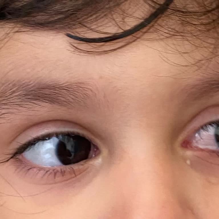 Göz Yakmaz İbaresi Yanıltıcı: Dalin Bebek Şampuanı Çocuğumun Gözlerinde Şiddetli Yanma