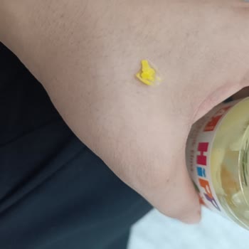 Hipp Organik Elma Püresinde Plastik Parça Ve Tanımsız Madde