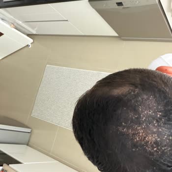 Ürün Saç Dökülmesine Neden Oluyor Ve Müşteri Hizmetleri Cevapsız
