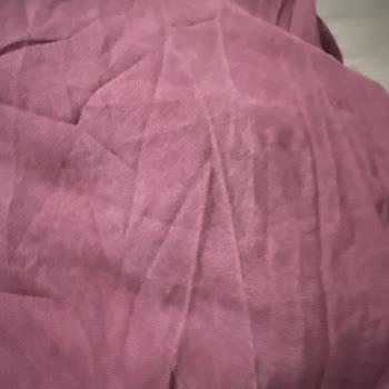 Renk Atan Tuniğin İadesi Ve 2000 TL Geri Ödeme Talebi