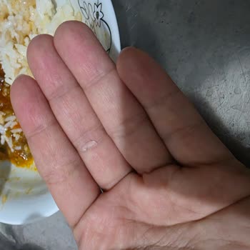 Yayla Agro Pirinçte Cam Parçası Çıktı Kardeşimi Tehlikeye Soktu