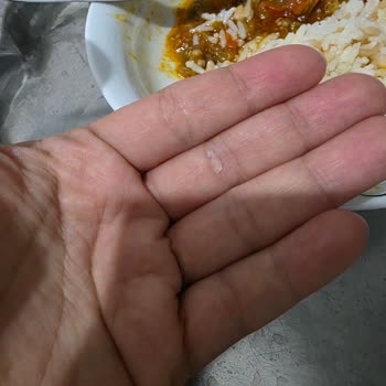 Yayla Agro Pirinçte Cam Parçası Çıktı Kardeşimi Tehlikeye Soktu