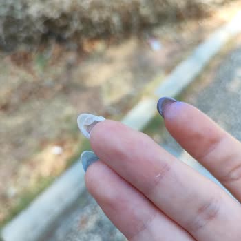 Hijyen Ve İşçilik Eksikliği Nedeniyle Sağlık Sorunu Yaşadım