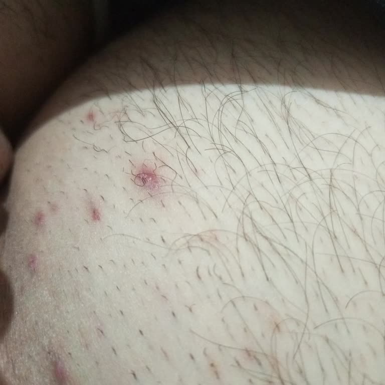 Gratis’ten Alınan Orien Erkek Tüy Dökücü Ürününün Ciltte Alerjik Reaksiyon Ve Etkisizliği