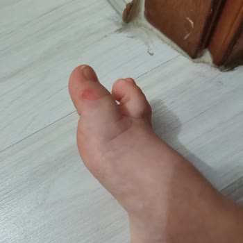 Ayakkabının Dikişi Çocuğumun Ayağını Yaraladı Ve Mağaza Çözüm Sunmadı