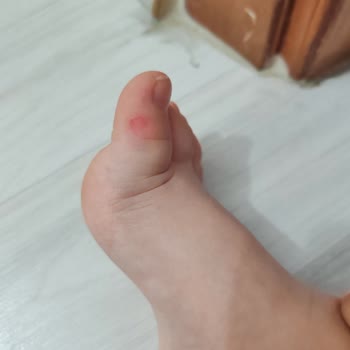 Ayakkabının Dikişi Çocuğumun Ayağını Yaraladı Ve Mağaza Çözüm Sunmadı