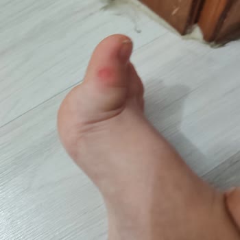 Ayakkabının Dikişi Çocuğumun Ayağını Yaraladı Ve Mağaza Çözüm Sunmadı