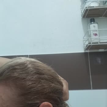 L'Oreal Saç Boyası Renk Vaadi Gerçekleşmedi, Geri Ödeme Talebi