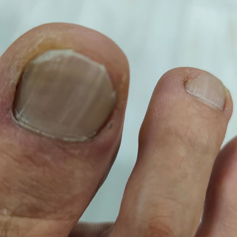 Ayakkabının Sert Plastik Bölümü Sağlık Sorununa Neden Oldu