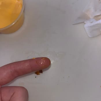 Kıl İçeren Döner Ve Görmezden Gelinen İade Talebi