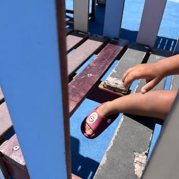 Kadıköy Suadiye Çocuk Parkı’nda Kırık Oyun Grupları Çocukları Tehlikeye Düşürüyor