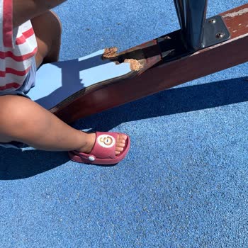 Kadıköy Suadiye Çocuk Parkı’nda Kırık Oyun Grupları Çocukları Tehlikeye Düşürüyor
