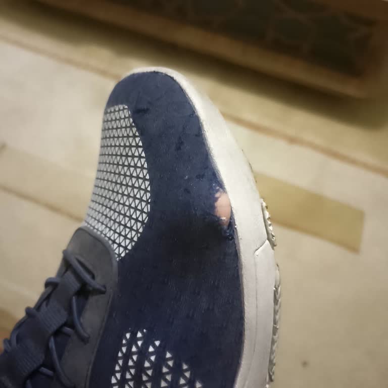 Yırtılan Ayakkabı Ve Şirketin Cevapsız Gecikmesi