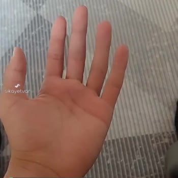 Erzurum Şehir Hastanesi'ne Artık El Cerrahisi Randevusu Açılmalı!