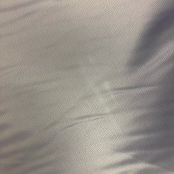 İki Defolu Elbise Ve Müşteri Hizmetleri Cevapsızlığı