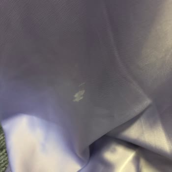 İki Defolu Elbise Ve Müşteri Hizmetleri Cevapsızlığı