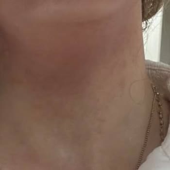 Mac Cosmetics Üründe Alerjik Problem Yaşama